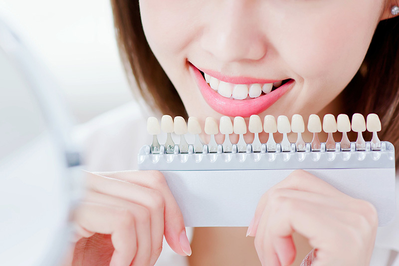 ホワイトニング